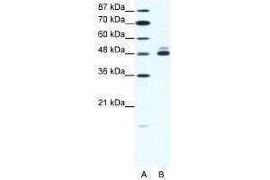 CHRNB2 antibody (20R-1324) used at 2. (CHRNB2 antibody  (N-Term))