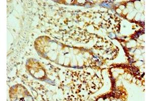 Immunohistochemistry of paraffin-embedded human small intestine tissue using ABIN7146219 at dilution of 1:100 (LI Cadherin antibody  (AA 573-832))