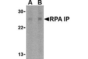 Western Blotting (WB) image for anti-RPA Interacting Protein (RPAIN) (C-Term) antibody (ABIN1030627) (RPAIN antibody  (C-Term))