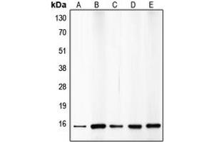 Western blot analysis of p15 INK4b expression in HepG2 (A), A549 (B), HeLa (C), mouse brain (D), rat kidney (E) whole cell lysates.