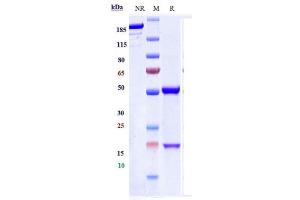Anti-IL-10 Reference Antibody (BT-063) on SDS-PAGE under reducing (R) condition.