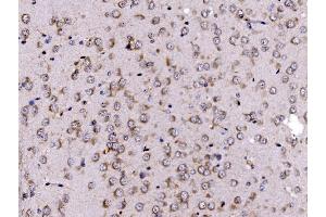 IHC analysis of FKBP135/FKBP15 using anti-FKBP135/FKBP15 antibody (ABIN7600397). (FKBP15 antibody  (AA 19-1210))