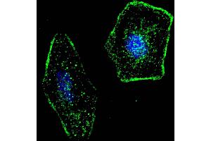 Fluorescent confocal image of SY5Y cells stained with ERAS (F66) antibody. (ERAS antibody  (N-Term))