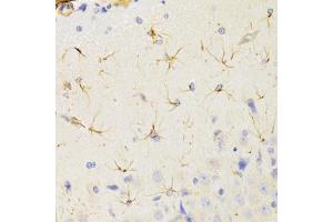Immunohistochemistry of paraffin-embedded rat brain using KIF1B Antibody (ABIN2563552) at dilution of 1:100 (40x lens). (KIF1B antibody)