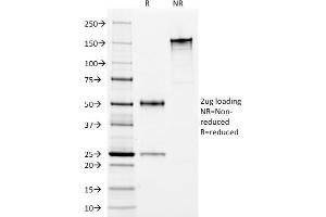 SDS-PAGE Analysis Purified HLA-DP/DR Mouse Monoclonal Antibody (Bra-14). (HLA-DPB1 & HLA-DRA antibody)