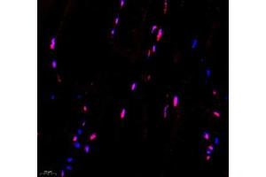 Immunofluorescence of paraffin embedded mouse Skeletal muscle using Troponin I (ABIN7076031) at dilution of 1:650 (400x lens) (TNNI2 antibody)