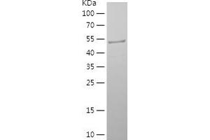 Western Blotting (WB) image for Phosphoglucomutase 2 (PGM2) (AA 167-366) protein (His-IF2DI Tag) (ABIN7124411) (Phosphoglucomutase 2 Protein (PGM2) (AA 167-366) (His-IF2DI Tag))