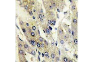 Immunohistochemical analysis of Catalase (pY386) staining in human liver formalin fixed paraffin embedded tissue section. (Catalase antibody  (pTyr386))