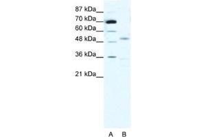 Western Blotting (WB) image for anti-Cholinergic Receptor, Nicotinic, alpha 3 (Neuronal) (CHRNA3) antibody (ABIN2463738) (CHRNA3 antibody)