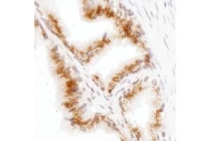 anti-Golgi Reassembly Stacking Protein 2, 55kDa (GORASP2) (AA 400-450) antibody