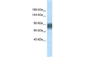 WB Suggested Anti-Avil Antibody Titration: 1.
