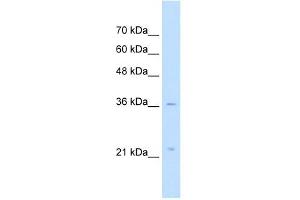 LAPTM4A antibody used at 5 ug/ml to detect target protein.