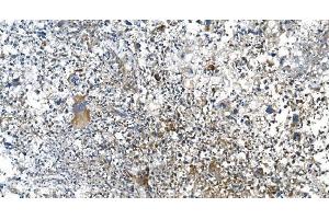 IHC analysis of DRP1/DNM1L using anti-DRP1/DNM1L antibody (ABIN7602180).