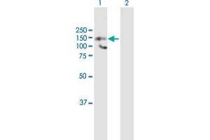 Western Blot analysis of HDAC9 expression in transfected 293T cell line by HDAC9 MaxPab polyclonal antibody. (HDAC9 antibody  (AA 1-1069))