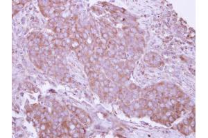 Immunohistochemistry (IHC) image for anti-CD27 Molecule (CD27) antibody (ABIN2855821)