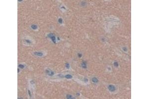 Used in DAB staining on fromalin fixed paraffin- embedded Kidney tissue (UBE2K antibody  (AA 2-200))