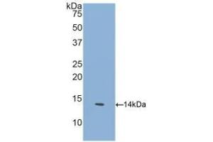 Detection of Recombinant GFRa1, Human using Polyclonal Antibody to Glial Cell Line Derived Neurotrophic Factor Receptor Alpha 1 (GFRa1) (GFRA1 antibody  (AA 239-350))