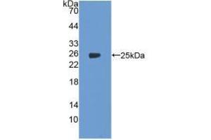 Figure. (PTGS2 antibody  (AA 418-589))