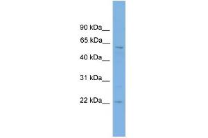 WB Suggested Anti-FTO Antibody Titration:  0.