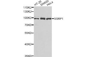 Western blot analysis of extracts of various cell lines, using SSRP1 antibody (ABIN5973814) at 1/1000 dilution. (SSRP1 antibody)