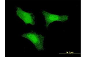 Immunofluorescence of monoclonal antibody to FGF1 on HeLa cell. (FGF1 antibody  (AA 46-155))