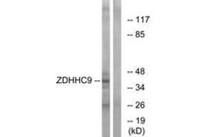 Western Blotting (WB) image for anti-Zinc Finger, DHHC-Type Containing 9 (ZDHHC9) (AA 315-364) antibody (ABIN2879195)