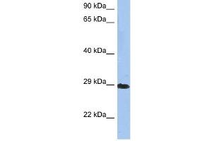 Crystallin Beta A1 antibody used at 1 ug/ml to detect target protein. (CRYBA1 antibody  (N-Term))
