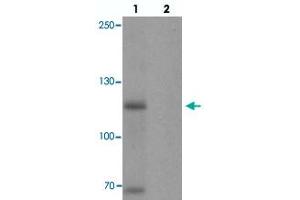 Western blot analysis of MYT1L in mouse brain tissue with MYT1L polyclonal antibody  at 1 ug/mL in (1) the absence and (2) the presence of blocking peptide. (MYT1L antibody  (C-Term))