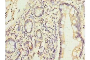 Immunohistochemistry of paraffin-embedded human small intestine tissue using ABIN7165622 at dilution of 1:100 (C17orf66 antibody  (AA 1-219))