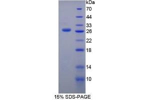 SDS-PAGE (SDS) image for Thyroglobulin (TG) (AA 2418-2660) protein (His tag) (ABIN2126958) (Thyroglobulin Protein (TG) (AA 2418-2660) (His tag))