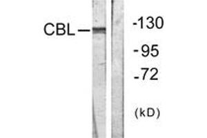 Western blot analysis of extracts from HepG2 cells, treated with Na2VO3 0. (CBL antibody  (AA 640-689))