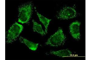 Immunofluorescence of monoclonal antibody to MOGAT3 on HeLa cell. (MOGAT3 antibody  (AA 59-107))