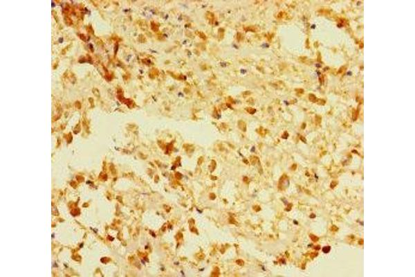 ACOT6 antibody  (AA 1-207)