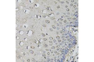 Immunohistochemistry of paraffin-embedded human esophagus using AMPD1 antibody. (AMPD1 antibody)