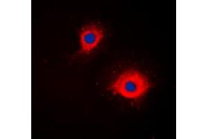 Immunofluorescent analysis of CD254 staining in Jurkat cells. (RANKL antibody  (Center))