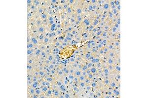 Immunohistochemistry of paraffin embedded mouse liver using ApoA2 (ABIN7073083) at dilution of 1:650 (300x lens) (APOA2 antibody)