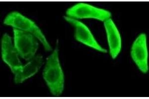 Detection of GAPDH in HepG2 cells using Polyclonal Antibody to Glyceraldehyde-3-Phosphate Dehydrogenase (GAPDH) (GAPDH antibody  (AA 154-324))