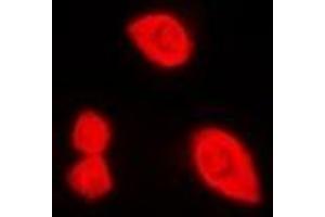 Immunofluorescent analysis of DDX3X (pT322) staining in HeLa cells. (DDX3X antibody  (pSer322))