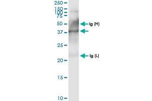 Immunoprecipitation of PECI transfected lysate using anti-PECI MaxPab rabbit polyclonal antibody and Protein A Magnetic Bead , and immunoblotted with PECI MaxPab rabbit polyclonal antibody (D01) . (PECI/ECI2 antibody  (AA 1-364))