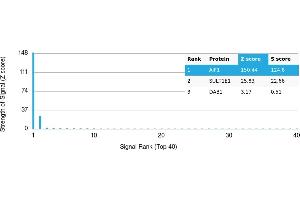 Protein Array (PAr) image for anti-Ionized Calcium-binding Adapter Molecule 1 (IBA1) antibody (ABIN7456154)