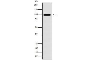 Western blot analysis of RanBP9 expression in HeLa cell lysate. (Recombinant Importin 9 antibody)