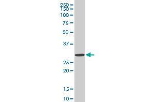 SIX3 monoclonal antibody (M02), clone 3F1. (SIX3 antibody  (AA 273-332))