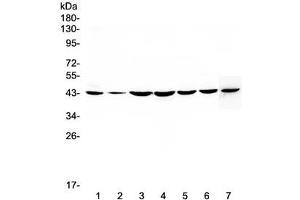 Western blot testing of human 1) HeLa, 2) placenta, 3) COLO-320, 4) PANC-1, 5) HepG2, 6) MDA-MB-231 and 7) mouse NIH3T3 lysate with FLIP antibody at 0.
