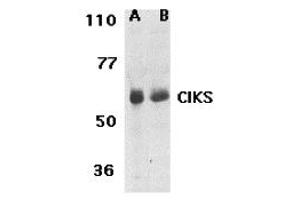 Western Blotting (WB) image for anti-TRAF3 Interacting Protein 2 (TRAF3IP2) (N-Term) antibody (ABIN1031321) (TRAF3IP2 antibody  (N-Term))