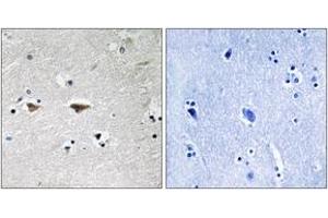 Immunohistochemistry (IHC) image for anti-Proto-oncogene tyrosine-protein kinase Src (Src) (AA 41-90) antibody (ABIN2889119) (Src antibody  (AA 41-90))