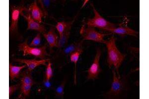 Immunofluorescence (IF) image for anti-Epithelial Cell Adhesion Molecule (EPCAM) antibody (Alexa Fluor 594) (ABIN2656829) (EpCAM antibody  (Alexa Fluor 594))