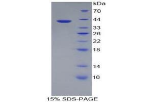 SDS-PAGE (SDS) image for Transferrin Receptor 2 (TFR2) (AA 604-703) protein (His tag,GST tag) (ABIN1171486)