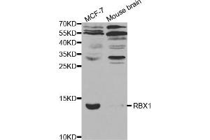 Western blot analysis of extracts of various cell lines, using RBX1 antibody (ABIN5970933) at 1/1000 dilution. (RBX1 antibody)