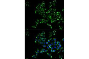 Immunofluorescence analysis of HeLa cell using TNFSF11 antibody. (RANKL antibody  (AA 78-317))