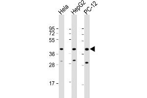 All lanes : Anti-PK14 Antibody  at 1:2000 dilution Lane 1: Hela whole cell lysate Lane 2: HepG2 whole cell lysate Lane 3: PC-12 whole cell lysate Lysates/proteins at 20 μg per lane. (MAPK14 antibody  (AA 301-330))
